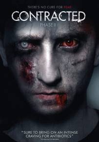 Contracted - Fase II